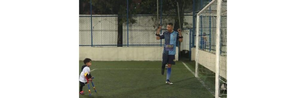 Claudinei e Heitor precisaram retirar a perna por motivos diferentes