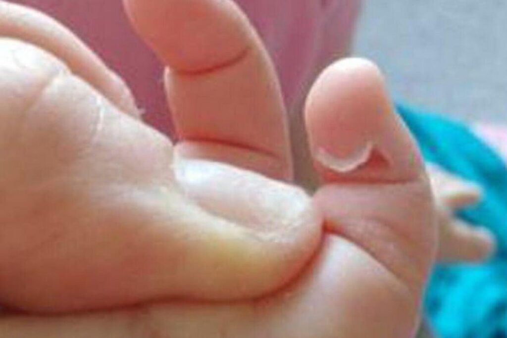 A gaivota atacou a criança enquanto ela estava segurando um biscoito