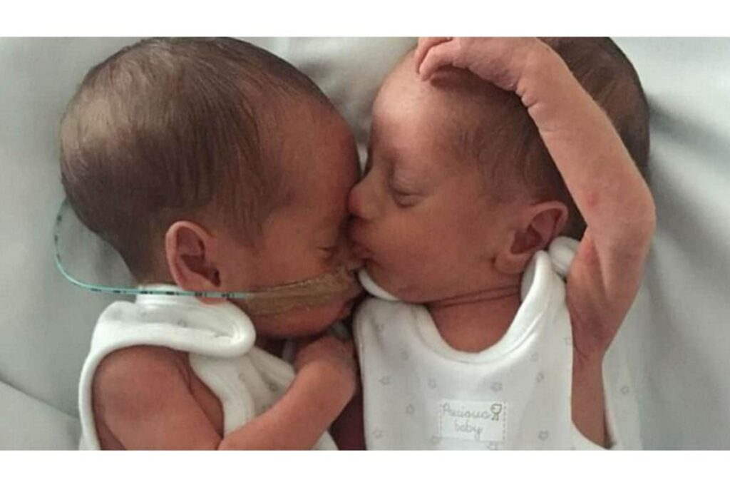 Atualmente os meninos estão super bem