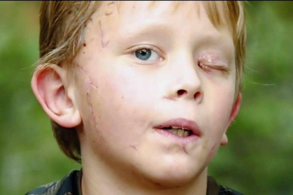 Pike sobreviveu ao ataque!