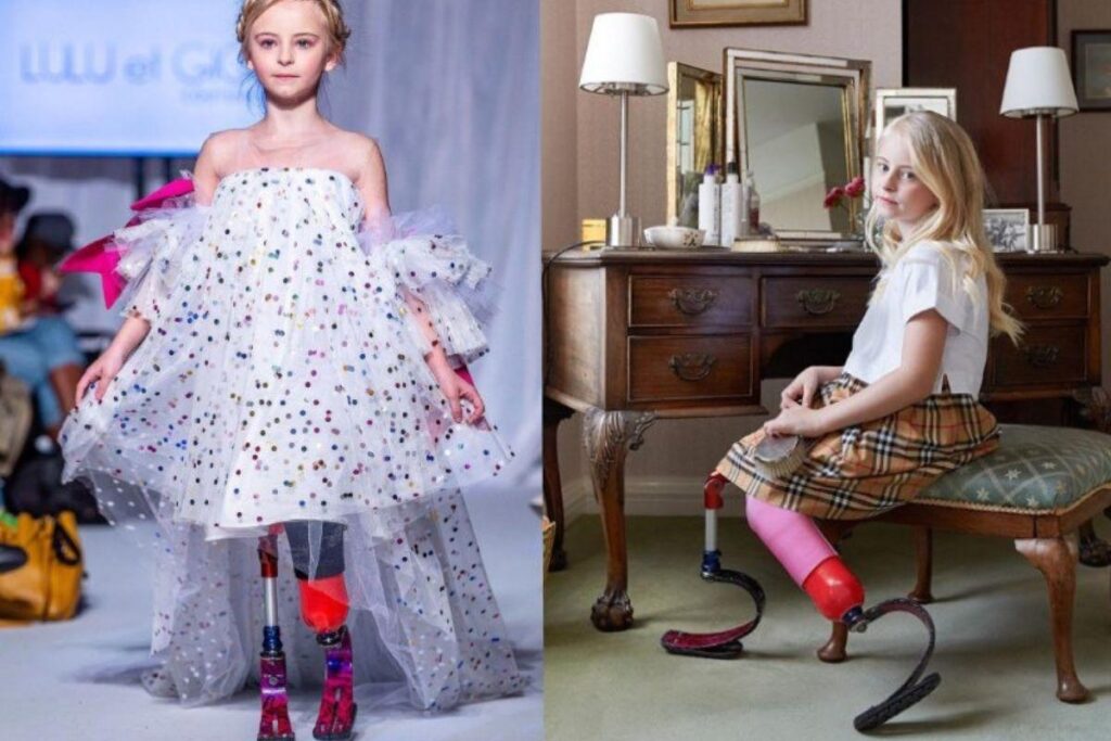 Menina de 9 anos com próteses arrasa nas passarelas