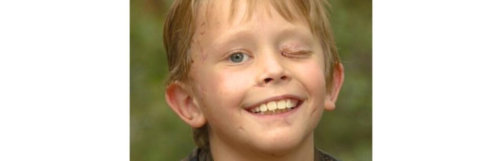 O animal o arrastou para uma árvore