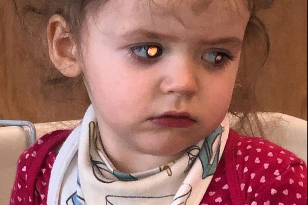 A cirugia foi um sucesso, mas Boo precisa iniciar o ciclo de quimioterapia para diminuir o tumor