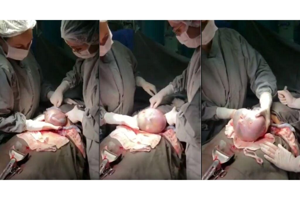 Quíntuplos nasceram no dia 2 de setembro