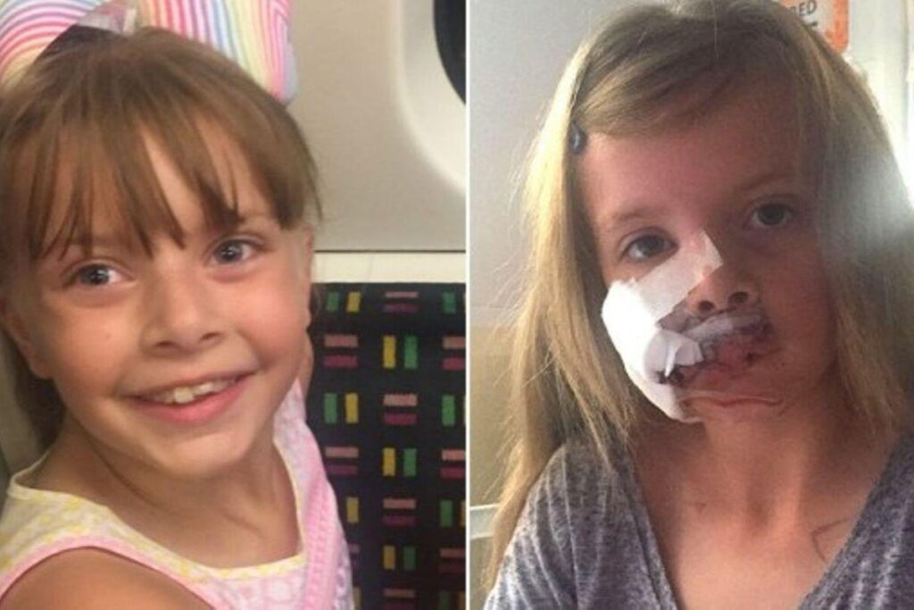 Lily-Fay Parfitt levou 230 pontos no rosto