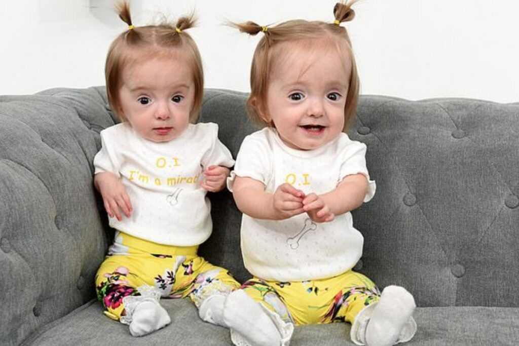 Os gêmeos junto aos pais e a irmã