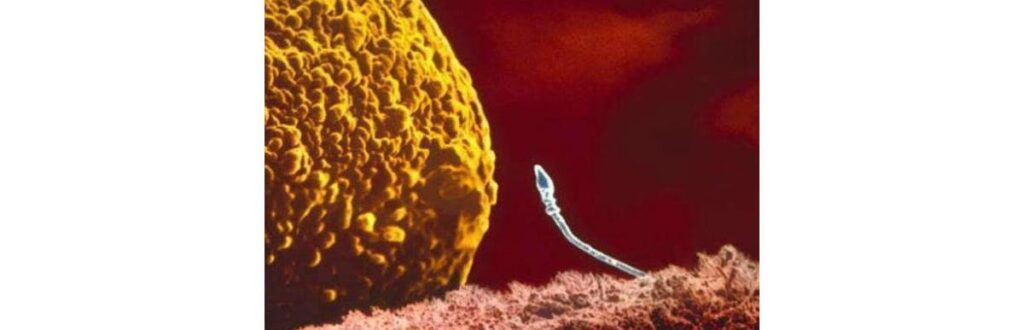 Homem doa esperma e as 12 crianças nascem com autismo