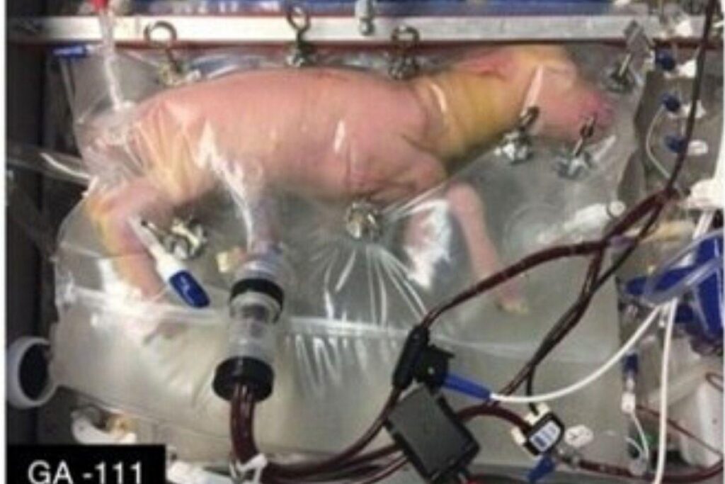 O teste foi desenvolvido nos Estados Unidos