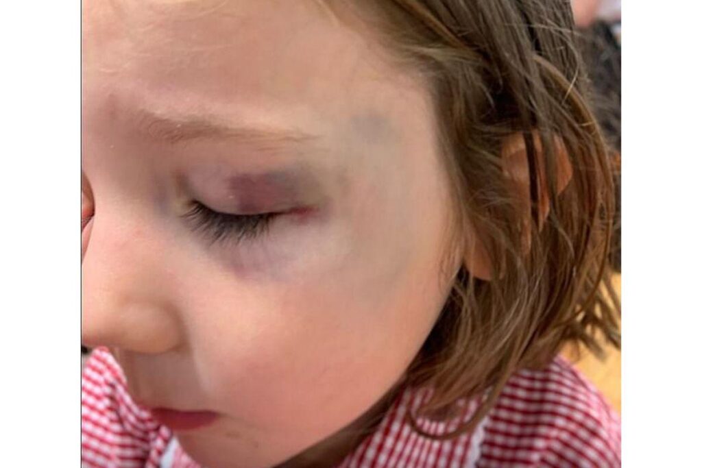 A mãe compartilhou a dica em sua rede social após filha receber alta do hospital