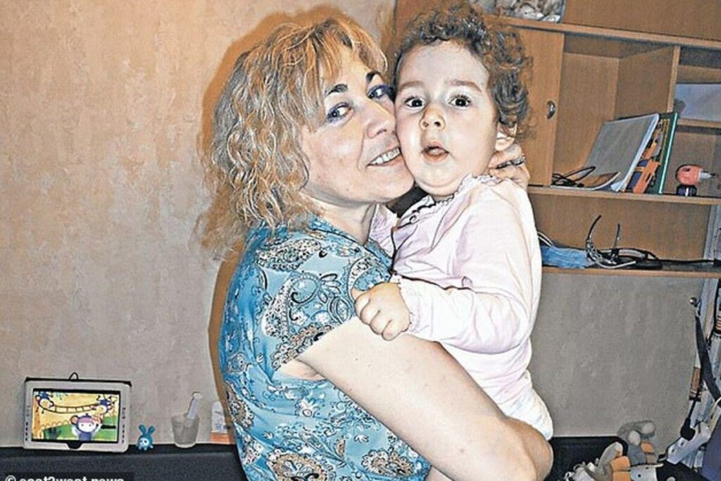 A criança nasceu com uma condição genética rara