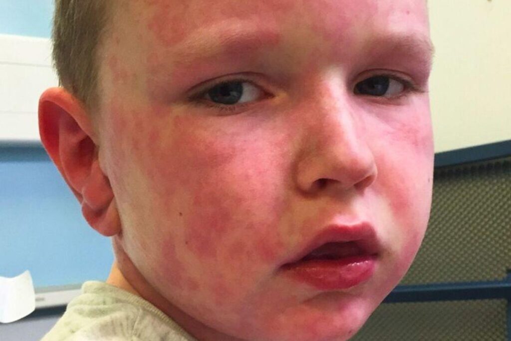 Ele precisa ficar sempre em temperatura ambiente