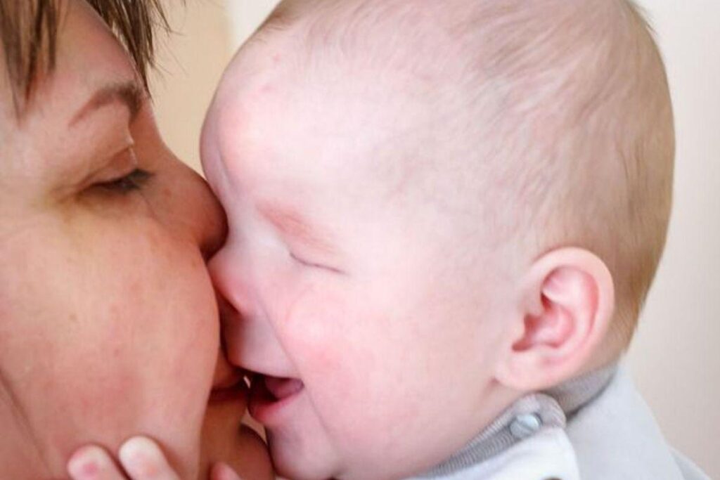 Ele é o terceiro caso no mundo