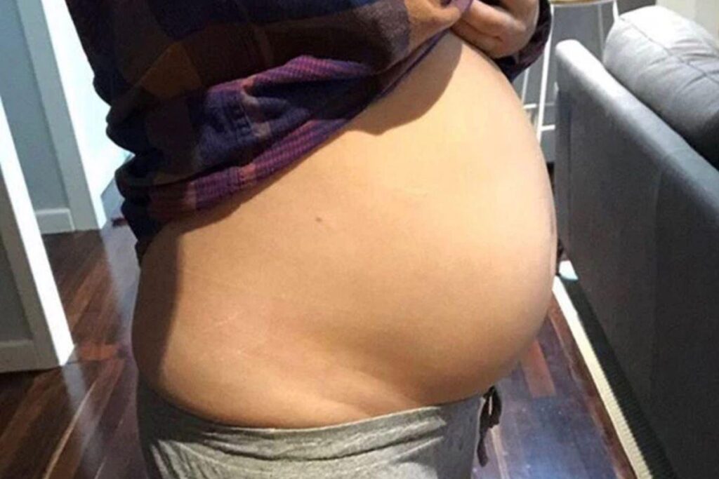 Ela foi diagnosticada aos 16 anos