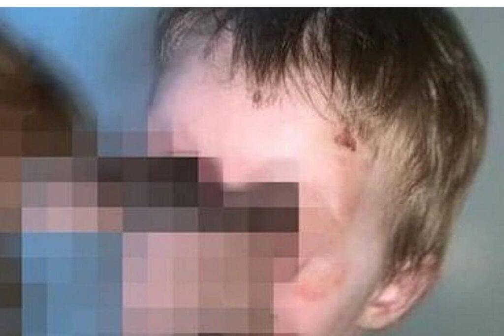 As mulheres cansaram de pedir ajuda para o conselho tutelar e resolvera usar as redes sociais