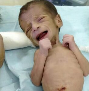 Dr. Khanna examinando a bebê