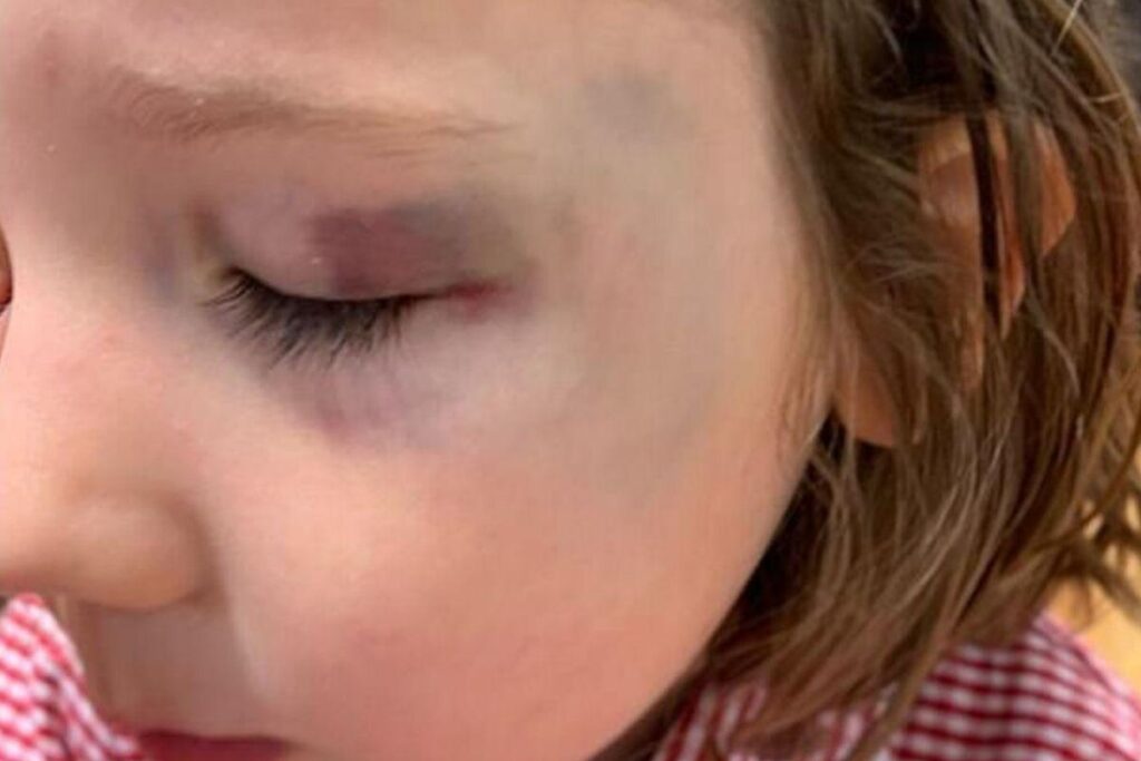 Foram usadas balas gelatinosas para o truque