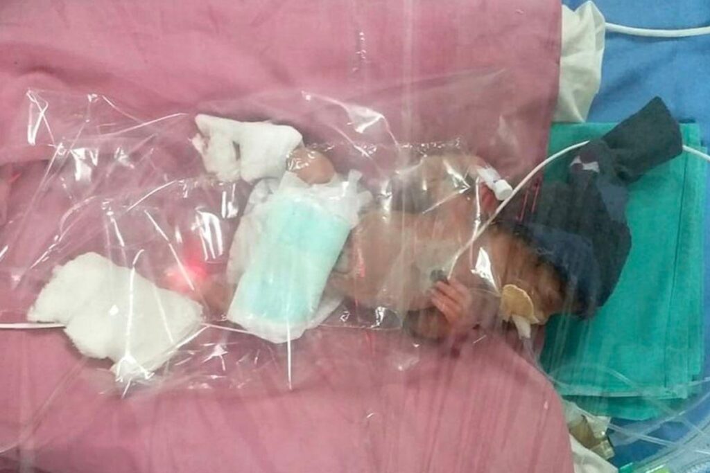 O processo foi feito a partir de uma fertilização in vitro