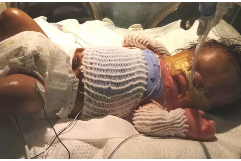 O menino depois da transformação