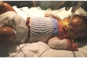 O menino depois da transformação