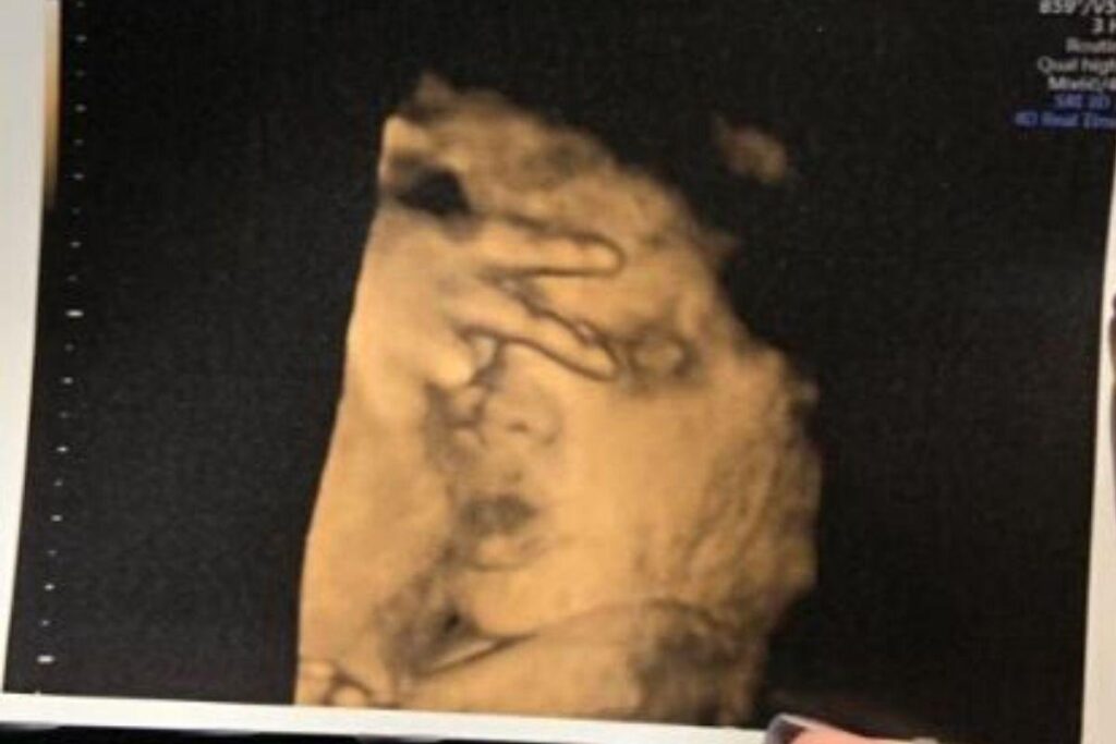 Jemma Houston teve uma surpresa ao ver o ultrassom