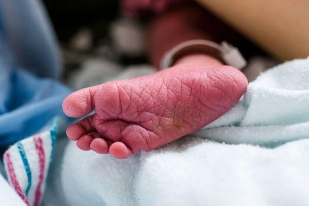 O bebê está se recuperando