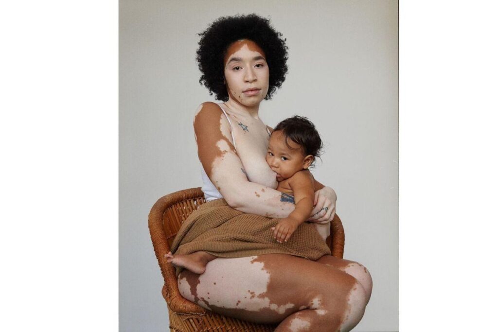 Jesi enfrenta o preconceito