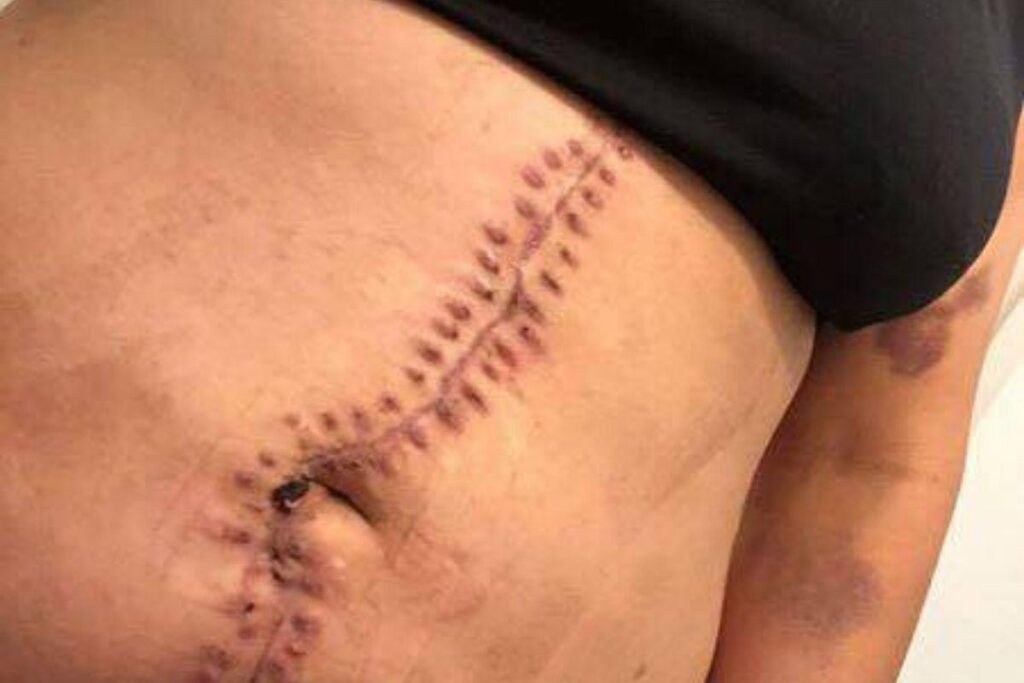 A mãe fez um batizado para a filha antes da menina morrer