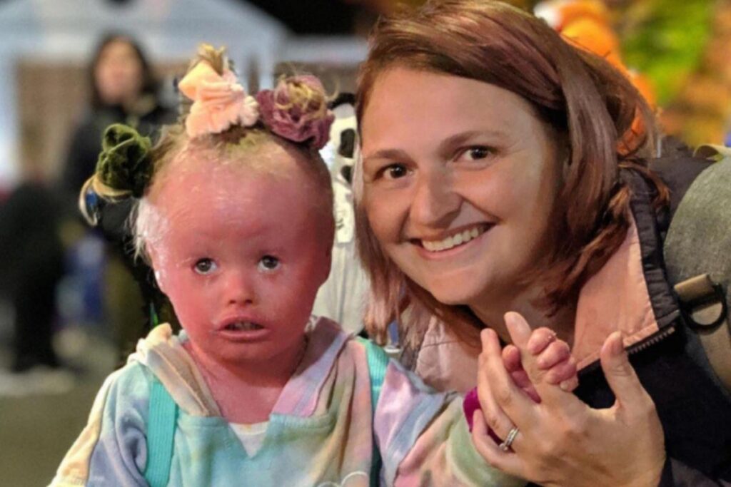 Jennie e Anna lutam todos os dias contra o preconceito