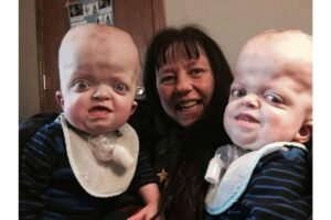 Matthew e Marshall tinham quatro semanas quando foram diagnosticados