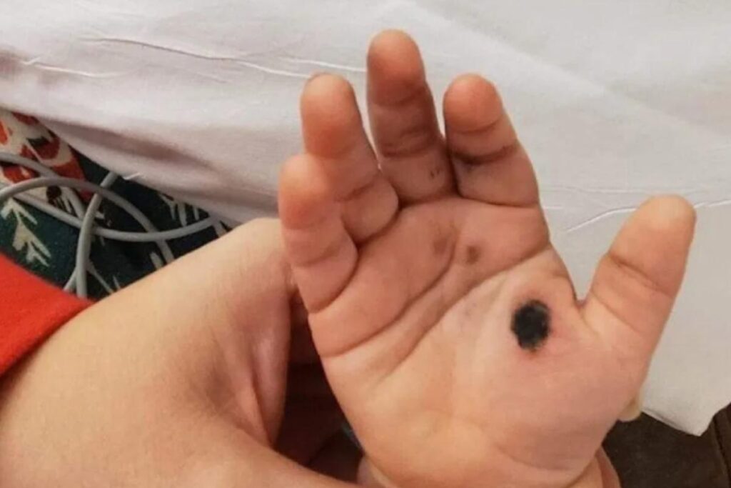 A bebê machucou a mão ao tentar colocar o carregador do celular na tomada