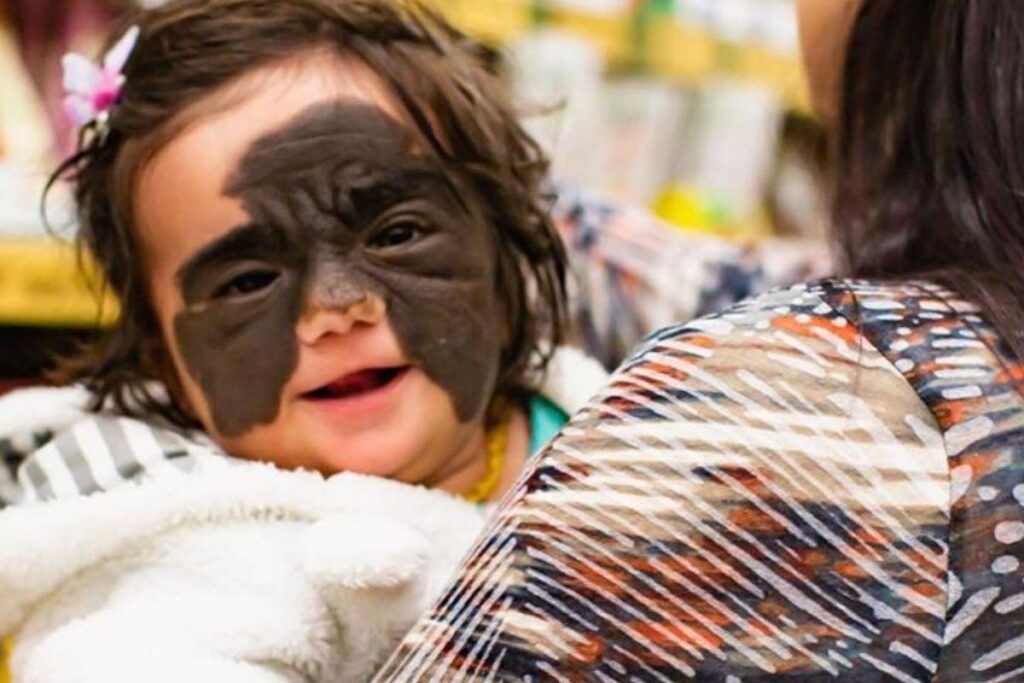 O tratamento dela está sendo feito na Rússia