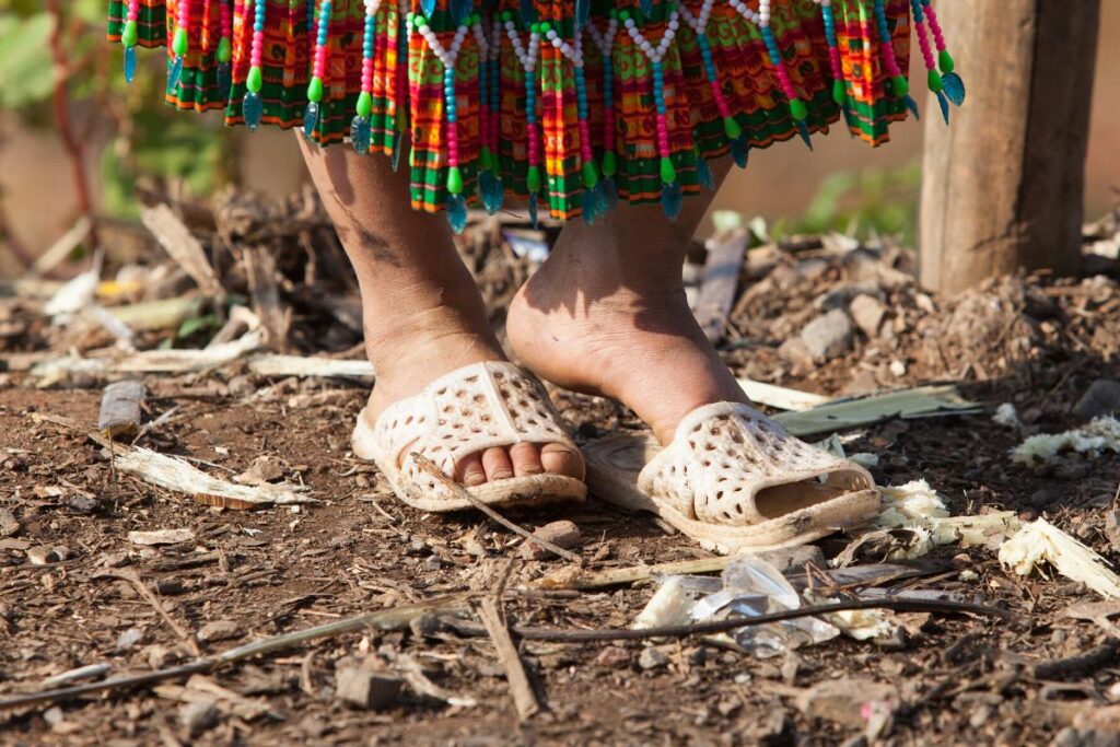 Raquel mora em um barracão improvisado em Palmas