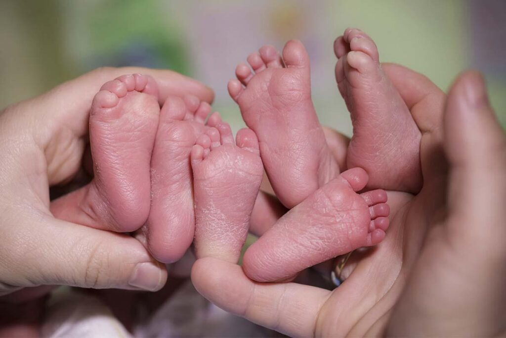 As meninas nasceram prematuras com 5 meses, mas já completaram 6 anos