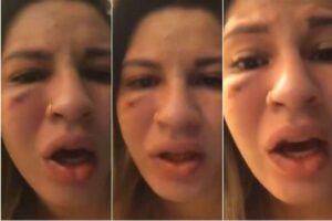 Ela levou oito socos do goleiro