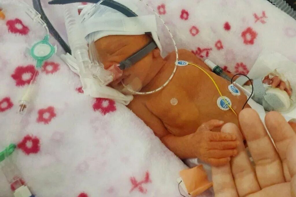 Ela foi considerada um milagre de natal