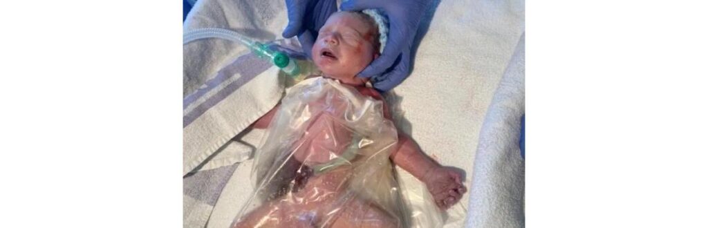 Os médicos usaram uma sacola plástica para proteger o órgão