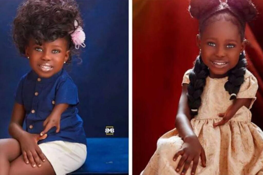 Tiaraoluwa nasceu com Deficiência Ulnar