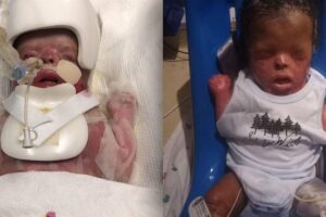 Ele ficou 11 meses internado