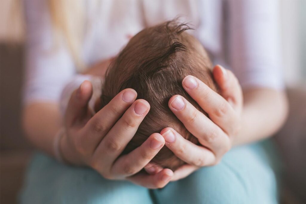 O bebê estava com uma cicatriz no rosto