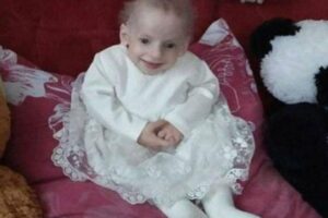 Anna sofria de uma doença rara