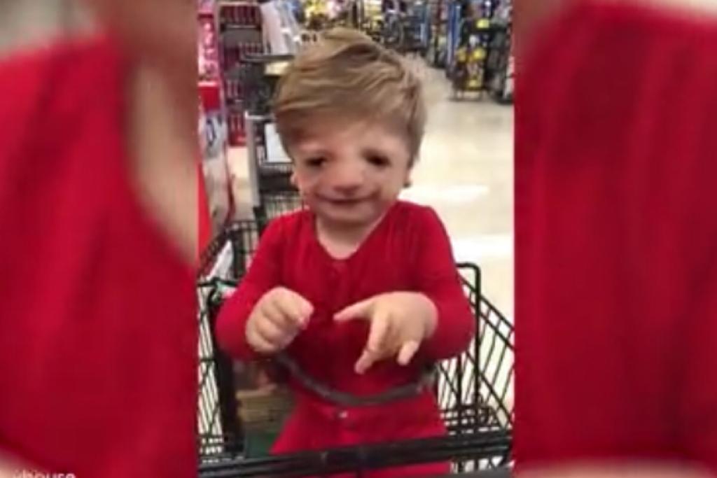 A Síndrome de Treacher Collins afeta os ossos do rosto