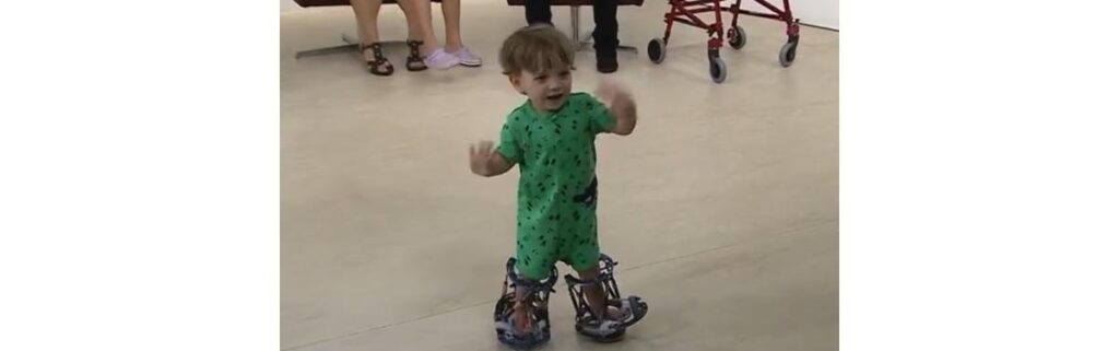 O menino nasceu com malformação nos ossos da perna