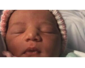 Como diferenciar a contração!