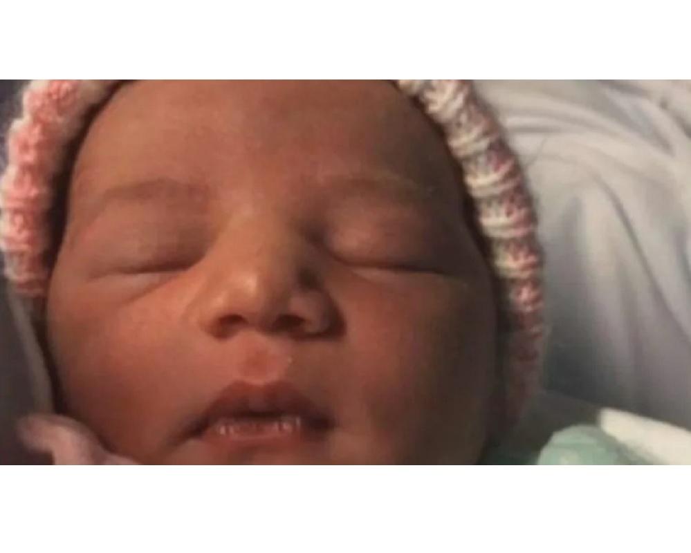 Como diferenciar a contração!