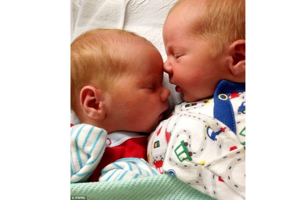 Mãe dá a luz aos gêmeos mais pesados da história da Escócia com mais de 7 quilos