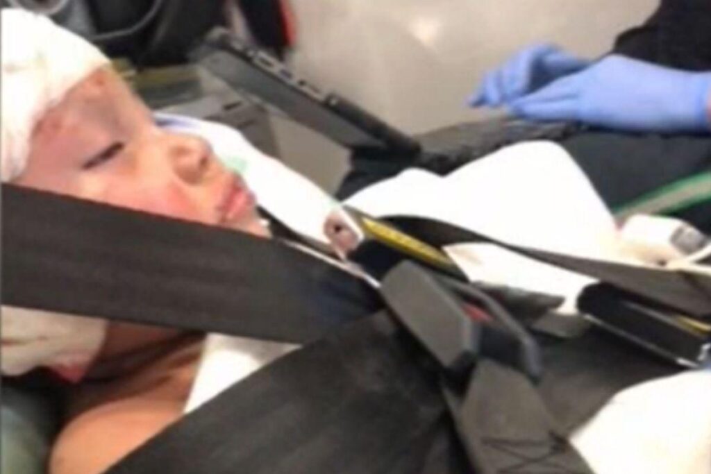 Ela passou por uma cirurgia reconstrutora