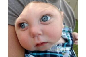 O americano Jaxon Buell nasceu com apenas 20% do cérebro desenvolvido, ele faleceu recentemente com 5 anos de idade