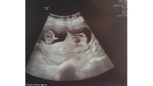 Enquanto Danielle estava internada e isolada, mandava fotos para a família para poder matar a saudade. Nesta, ela mostrava a torrada de seu café da manhã