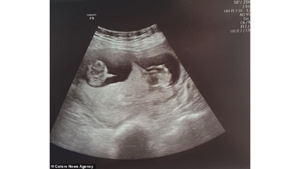 Enquanto Danielle estava internada e isolada, mandava fotos para a família para poder matar a saudade. Nesta, ela mostrava a torrada de seu café da manhã