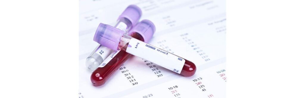 Novos alternativas para cura do novo coronavírus estão sendo feitas